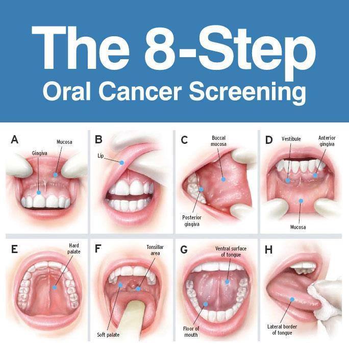 Oral Health Screening 107