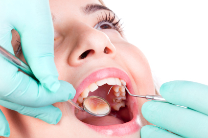 Dental fillings