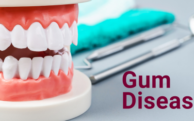 Keeping Your Gums Healthy